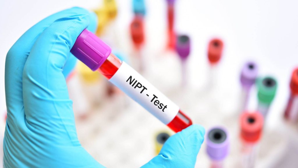 Mnegenal NIPT Test NIPT test dilakukan dengan mengambil sampel darah pada pembuluh vena ibu