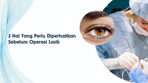 operasi lasik mata